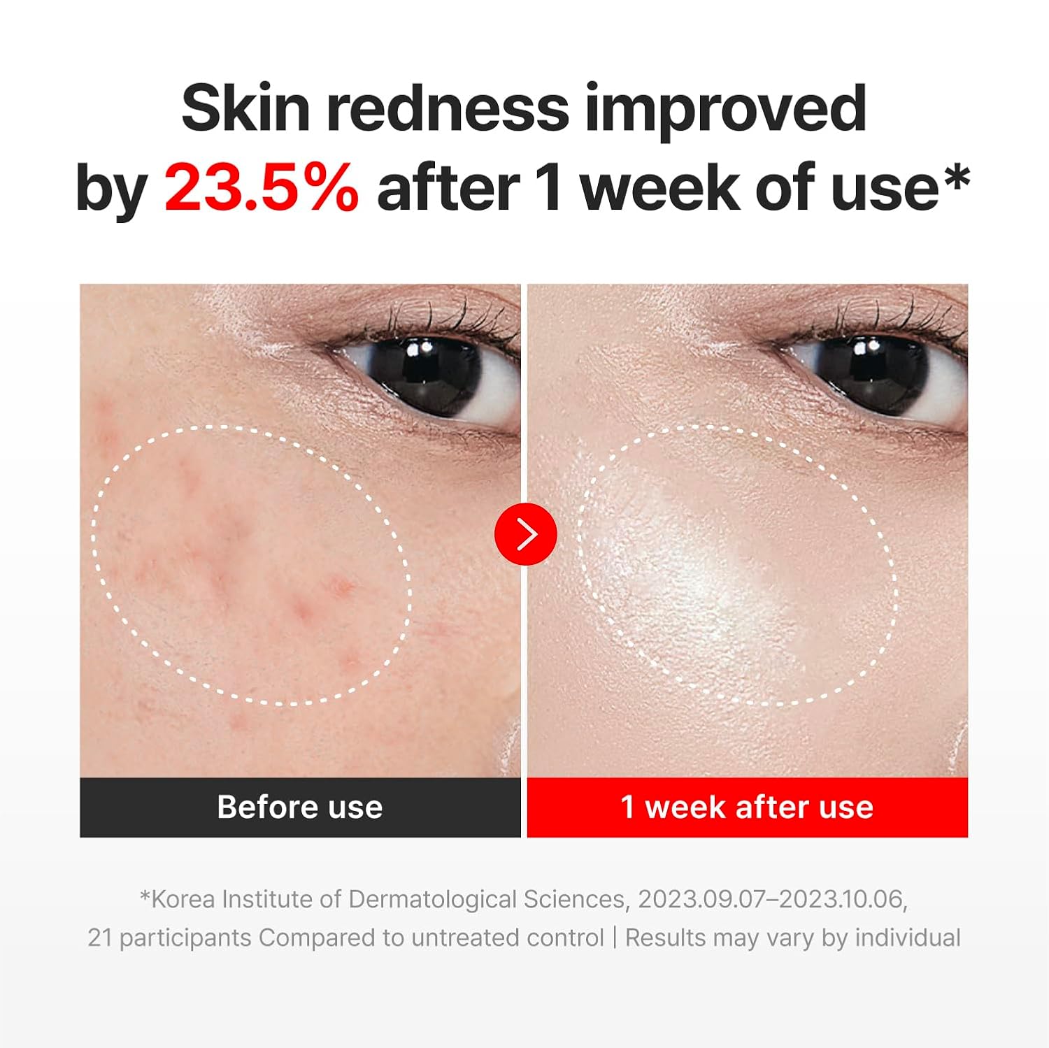 Centella Asiatica Face Cream – - Korean Skincare Routine 评论和价格