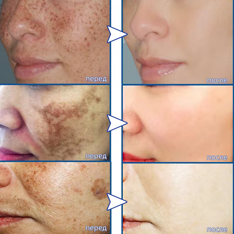 Powerful Spot-removing Whiteni - Korean Skincare Routine 评论和价格